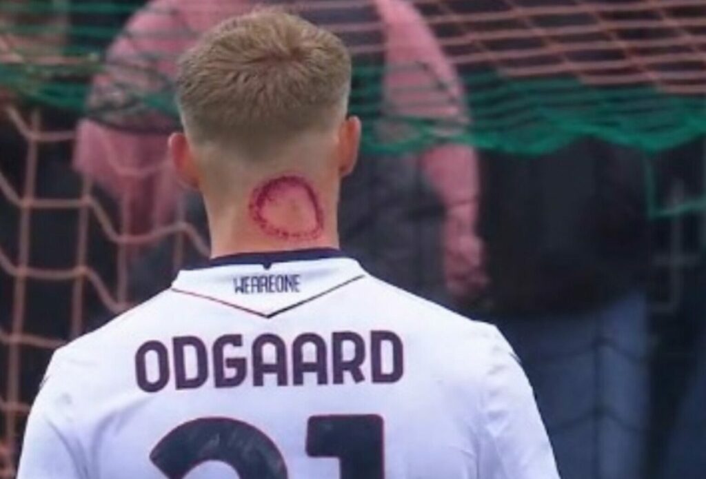 odgaard
